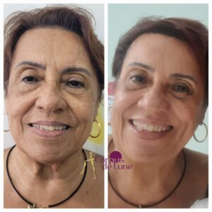 Estética1Luxuosa: Beleza aos 50+: estética e alma em harmonia