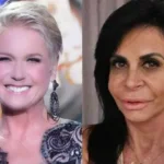 Dermatologistas explicam alopecia feminina, problema enfrentado por muitas mulheres