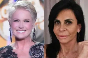 Dermatologistas explicam alopecia feminina, problema enfrentado por muitas mulheres