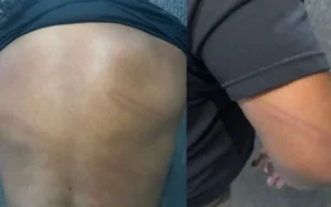 Ex-jogador do vasco e agredido após jogo e gera denúncia contra policial