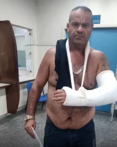 Vendendor agredido faz denuncia contra ação da Seop no Arpoador