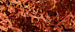 Especialistas alertam para avanço de vírus emergentes em 2026 diante de cenário global favorável a novas epidemias