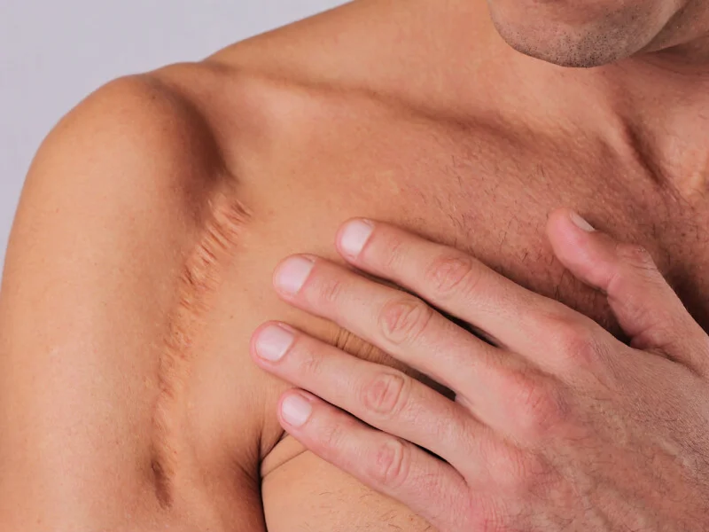 Reprodução Reprodução