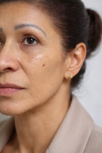 Saúde Viva: O que sua pele revela sobre sua história emocional