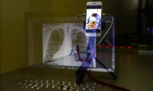 Projeto na Alerj cria regras para telessaúde no Rio e autoriza atendimentos remotos nas redes pública e privada