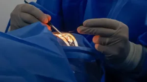 Primeiro transplante de córnea é realizado na Rede Municipal do Rio