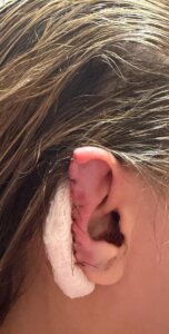 Laudo confirma deformidade permanente após agressão brutal em SP