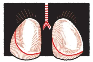  Novo tratamento imunobiológico de ultralonga ação para doenças respiratórias é aprovado no Brasil