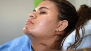 ‘Me fiz de morta’, diz estudante que teve as mãos amputadas em ataque com foice no Ceará
