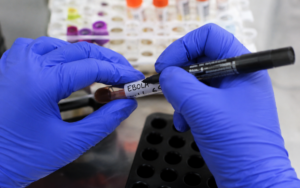 Suspeita de Ebola no Brasil mobiliza diversas autoridades, e testes dão negativo