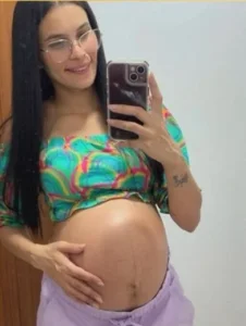 Grávida morre no Rio após intestino perfurar em parto