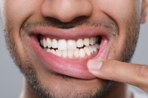 Saúde Bucal: Esses três sinais na boca podem indicar diabetes