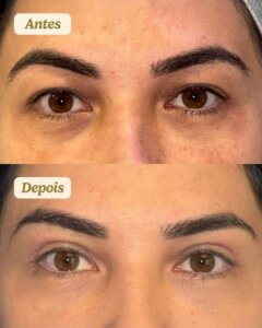 Beleza dos olhos